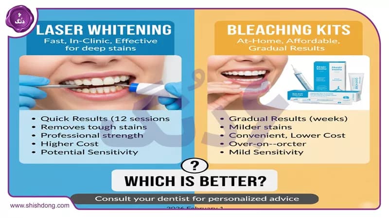 رازهای سفید کردن دندان برای عید ۱۴۰۵: لیزر vs بلیچینگ – کدام بهتر است؟ رازهای سفید کردن دندان برای عید ۱۴۰۵: لیزر vs بلیچینگ – کدام بهتر است؟